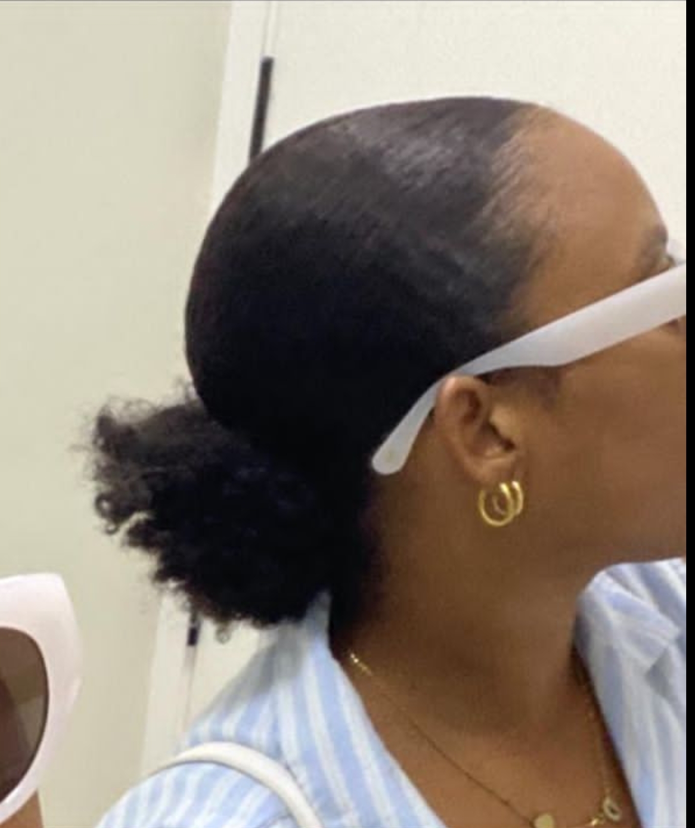 Évolution visuelle 1